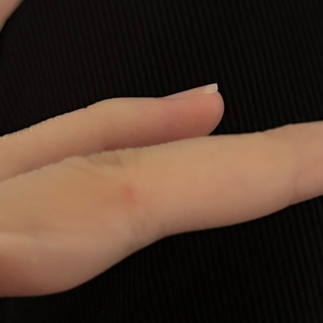 파나덤크림을 최대 몇 일 발라도 되나요?의 0번 째 이미지