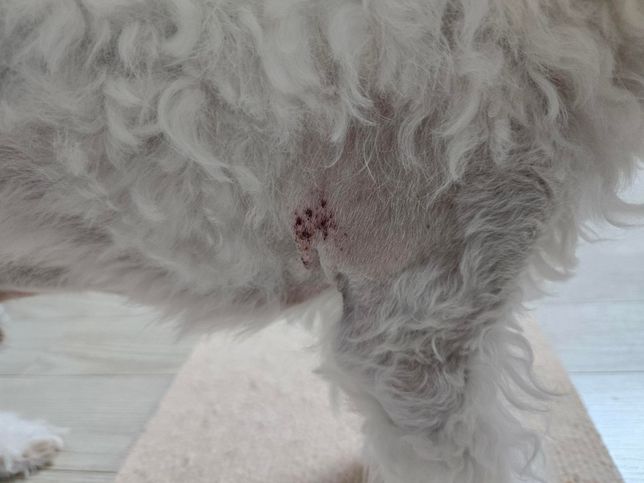 이런경우 무조건 다리절단이 최선인가요?의 0번 째 이미지