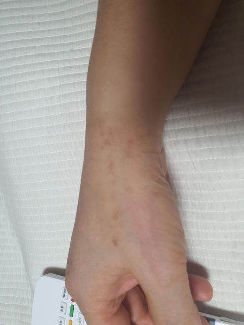 약사분께서 이 약 주셨는데 괜찮은걸까요?의 0번 째 이미지