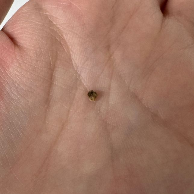 선인장 몸통에 까만 알갱이는 뭔가요?의 2번 째 이미지