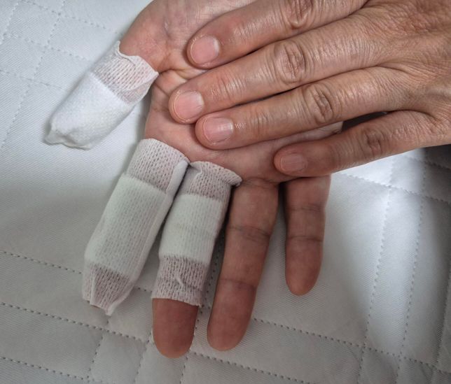 어머니께서 철수세미에 손이 많이 베였어요의 0번 째 이미지