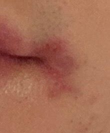 피부에 대해서 질문을 드리고 싶어요.의 0번 째 이미지