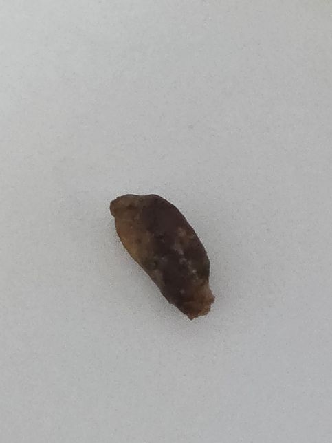 침대에서 벌견한 벌레 관련된거같은데 이게 뭘까요?의 0번 째 이미지