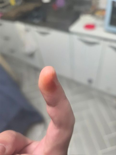 이 정도면 담배.. 끊어야할까요??의 2번 째 이미지