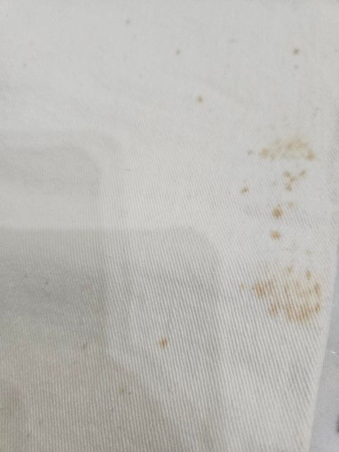 흰바지 무슨 얼룩일까요? 지워는 질까요의 0번 째 이미지