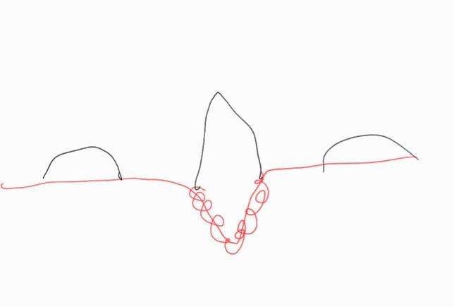 강아지 아래 송곳니 덧니가 갑자기 빠졌어요의 0번 째 이미지