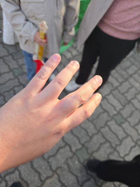 어린이가 가해자인 과실치상 합의불가 사건접수 가능여부 문의 건의 0번 째 이미지