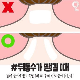 허리나, 뒷목 파스위치 ,양쪽으로 나눠서 붙이라던데 그냥 붙이면 효과가아예없나요??의 0번 째 이미지