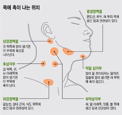 목 아래 부분이 아픈데 무슨병원을 가야할까요 ㅠ의 0번 째 이미지