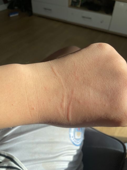 집에서 키우는 강아지 관견병 일수도있나요?의 0번 째 이미지