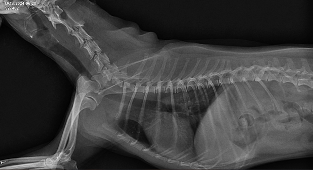 마른기침헛구역질이 점점 심해지고 있습니다 기관협착, 기관지염의 1번 째 이미지