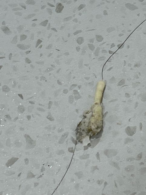 화장실 배수구망.?. 청소 하다 보인 건데 이게 뭔가요 어쩐지 물이 잘 안 내려가서 뜯어 보니 저런게 붙어 있았습니다 벌레 알 같은 걸까요..?의 0번 째 이미지