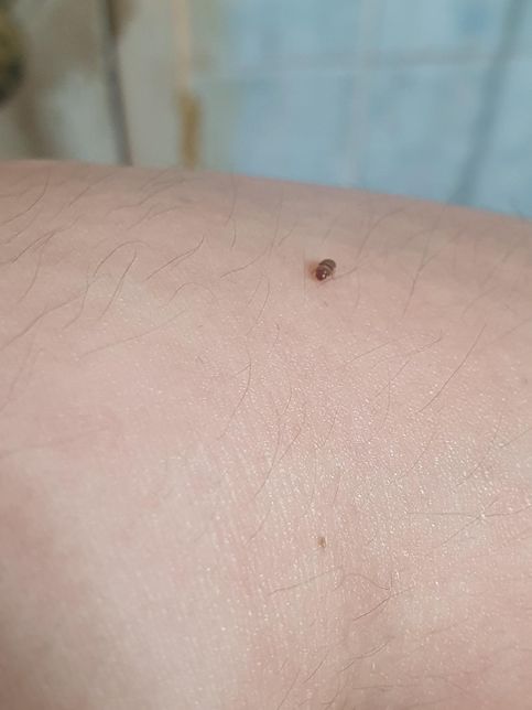 이 벌레 이름이 뭔가요?해충인가요?의 0번 째 이미지