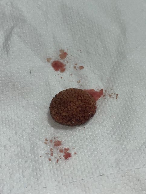 강아지 방광결석 대충 어떤 종류인 거 같나요?의 1번 째 이미지