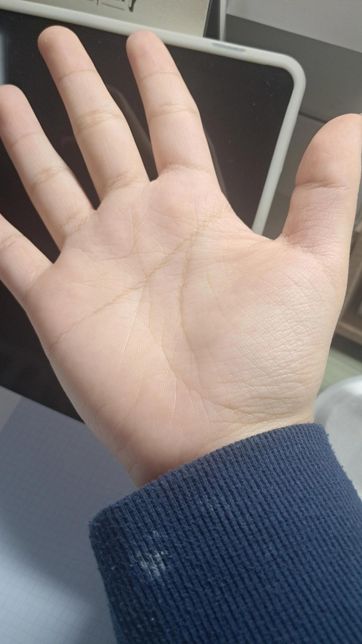 두뇌선때문에 생명선이 끊겨있어요ㅜ의 0번 째 이미지