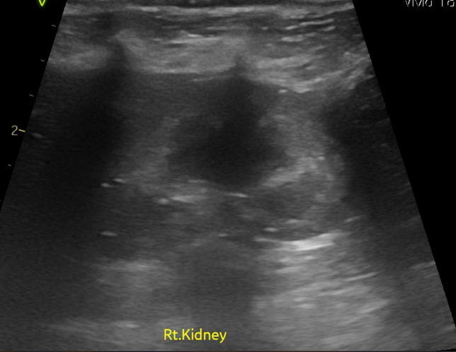 강아지 신장결석 종류 모양만으로는 추측도 불가능한가요?의 3번 째 이미지