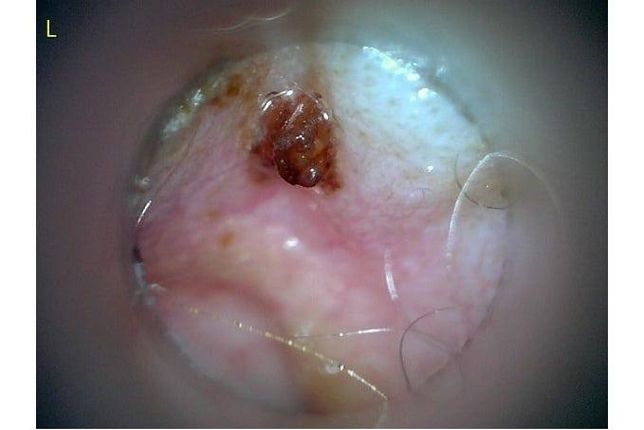 강아지 귀안인데 폴립같이 보이나요?의 0번 째 이미지
