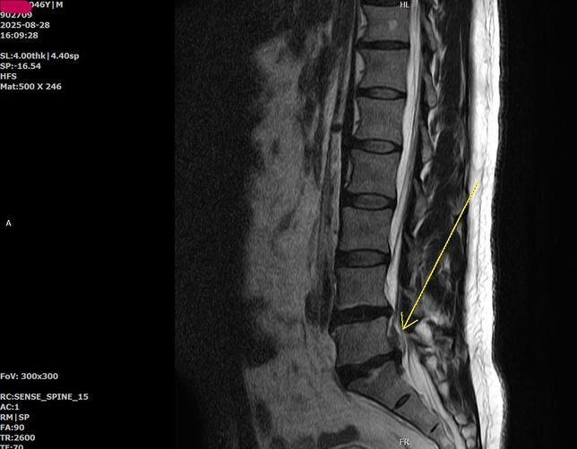 손해사정사 선임이 좋을까요?독고다이가 좋을까요?의 0번 째 이미지
