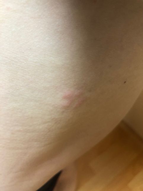 이거 약국에서 무슨 연고 사서 발라야하나요? 가격도요의 0번 째 이미지