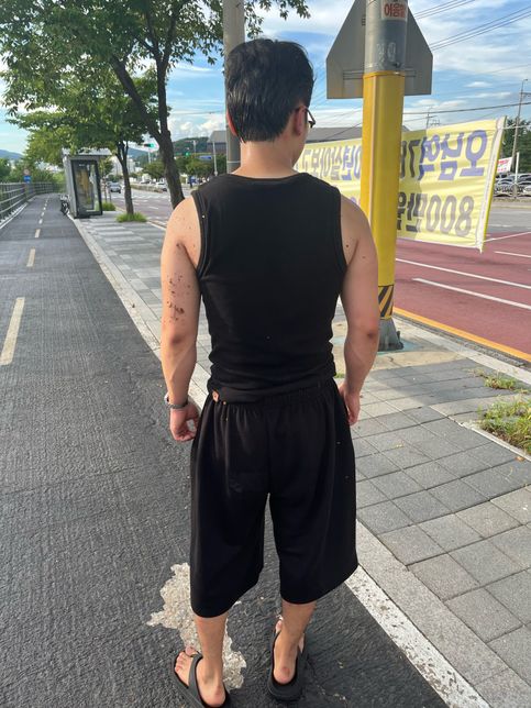 폭행관련 형사접수 및 쌍방이 가능한지의 1번 째 이미지