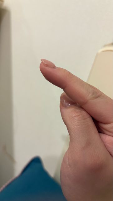 젤 네일 바른 검지손톱 측면에 검은부분 왜이러나요 곰팡이 인가요의 0번 째 이미지