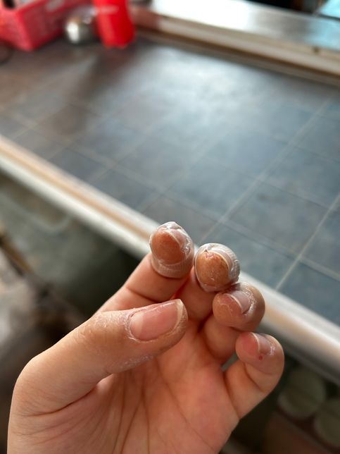 젤네일 알러지 때문잉가요 ˀ̣ 손가락 피부의 3번 째 이미지