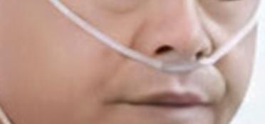 산소마스크,산소호흡기.인공호흡기는 다른건가요?의 1번 째 이미지