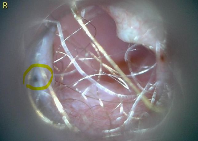 강아지 귀안 검은색 저 부분이 대체 뭘까요?의 1번 째 이미지