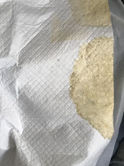 강아지 혈뇨의 원인이 신장결석 때문일수도 있나요?의 3번 째 이미지