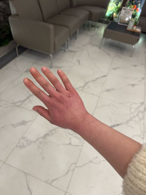 다이어트약 오남용으로 나타나는 증상 질병 유추하여 병원 알려주세요..의 3번 째 이미지