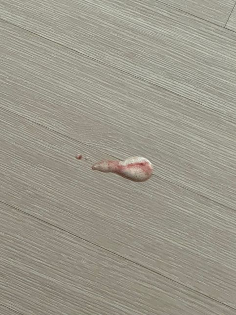 고양이 처음으로 열빙어 먹고 피 섞인 토의 2번 째 이미지