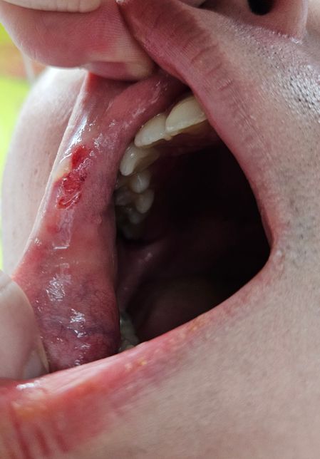 폭행, 상해사건 중 어떤 사건으로 처리가 될까요?의 0번 째 이미지