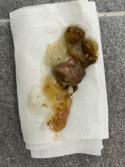 강아지 장폐색 의심 판단 부탁드립니다.의 3번 째 이미지
