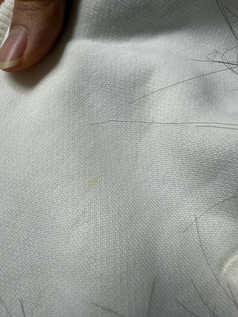 옷에 노란색 오염이 있는데 뭘로 지워야 지워질까요?ㅜ의 0번 째 이미지