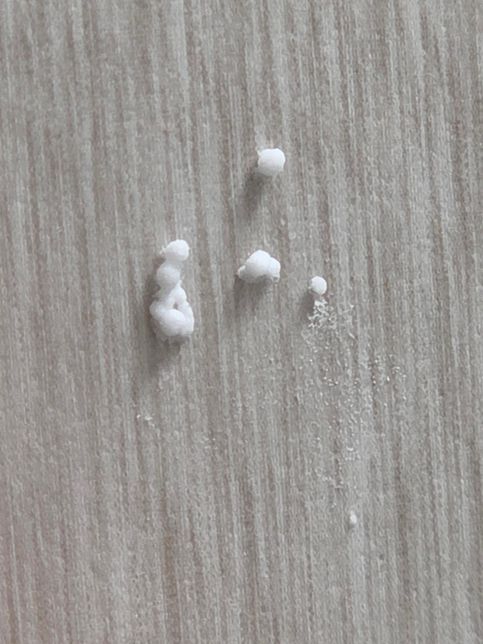 😵😵이게 뭘까요 정체를 모르겠어요ㅠㅠㅠ의 1번 째 이미지