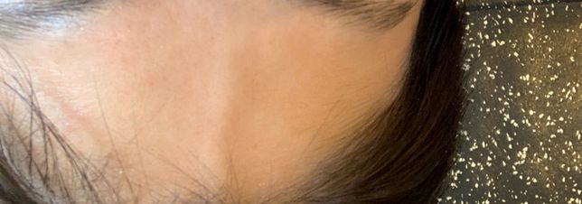 운동중에 이마에 혈관 튀어 나오는거 괜찮나요??의 0번 째 이미지