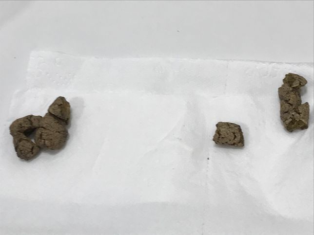 강아지가 변을 2-3일째 계속 이상하게 누는데 항상 이렇게 누는건 아니고 하루 5번 중에 1번은 꼭 이렇게 싼지 2-3일째이고 갈수록 점점 심해지는데 이유를 모르겠습니다의 2번 째 이미지