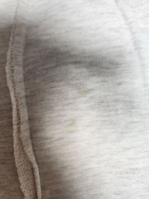 흰옷 세탁해도 안지워지는 얼룩 목라인 인체얼룩 제거방법의 3번 째 이미지