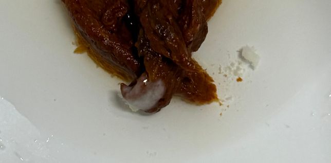 몇달전부터 흰색점액변이 보여요ㅠㅠ의 0번 째 이미지