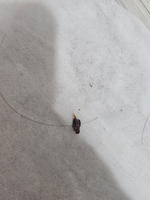 사진에 나와있는 벌레는 무슨 벌레인가요?의 0번 째 이미지