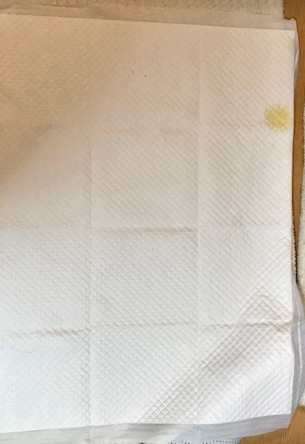 소변 세균배양검사 항생제 감수성 검사시 검출된 세균이 없는데 증상은 방광염일때의 0번 째 이미지