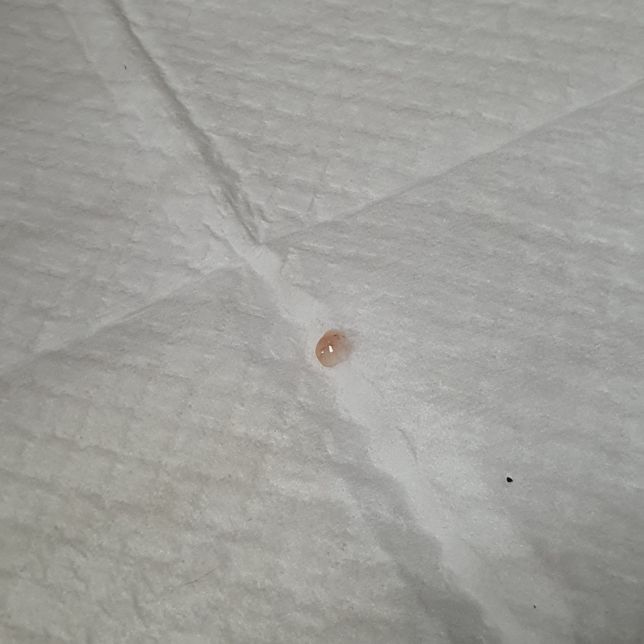 새끼강아지가 젤리변?혈변?을 봅니다의 1번 째 이미지