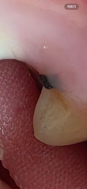 강아지 잇몸에 며칠 전부터 저런 게 생겼어요…의 0번 째 이미지