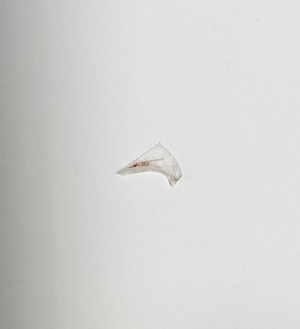 고양이에게서 자꾸 이상한 것이 나오는데,,, 이게 무엇인가요?의 0번 째 이미지