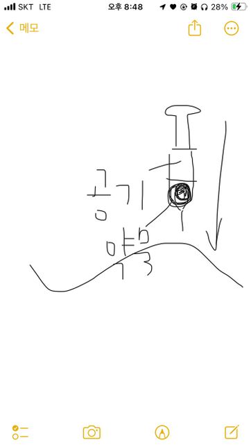 엉덩이 주사 잘 놓은걸까요?ㅠㅠㅠㅠ의 0번 째 이미지