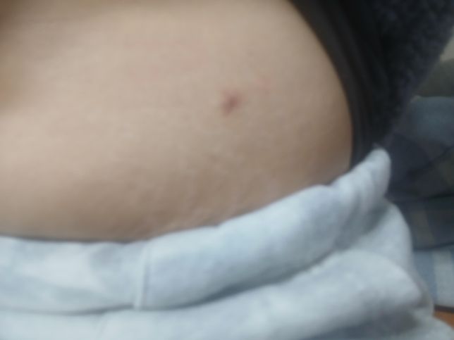 이거 물렷는데 먼지 궁금하데요ㅜㅜㅜ의 0번 째 이미지