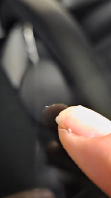 자동차 앞유리 스톤칩 복원해야 하나요?의 1번 째 이미지