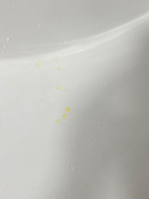 화장실 세면대.변기등에 노란물방울이 무엇일까요?의 0번 째 이미지
