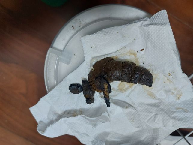 강아지 똥 군데 군데 검은색이에요ㅜㅜ의 0번 째 이미지