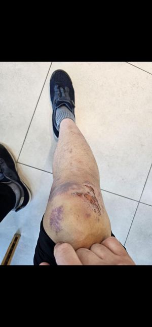 12월 19일 발산역 횡단보도 사고입니다ㅠㅠ의 1번 째 이미지